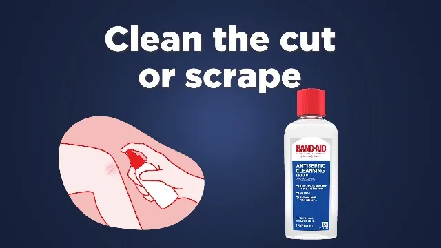 Band-Aid Flexible Fabric Review: First Aid Bandages image 7