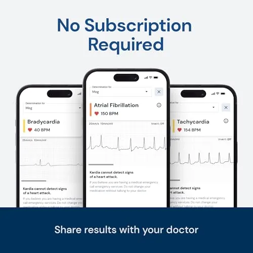KardiaMobile 1-Lead Review: Portable Personal EKG image 3
