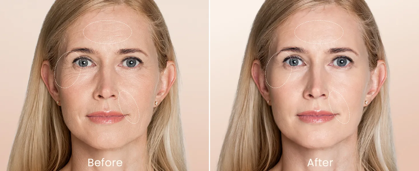 NEWKEY LED Face Mask Review: Red and Blue Light Therapy image 9