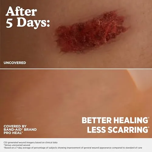BAND-AID Pro Heal Review: Waterproof Blister Bandages image 6