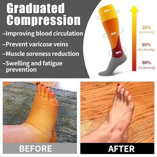 Bluemaple Compression Socks Review: Comfort and Value image 4