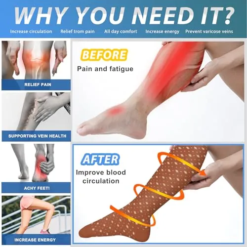 Aoliks Medical Compression Socks Review: Comfort and Value image 2