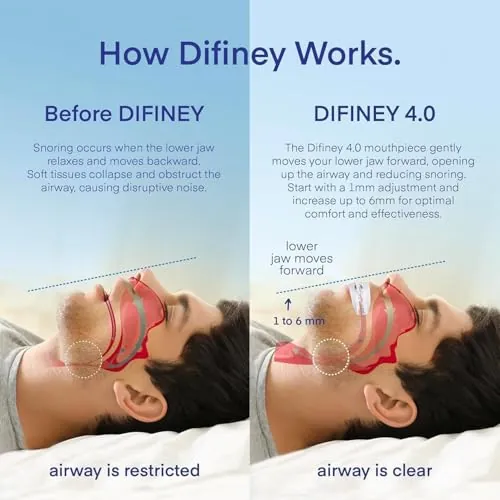 Difiney Advanced Anti Snoring Device 4.0 Review image 3